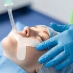 Leafix - The Laryngeal Endo-Tracheal Airway Fixator